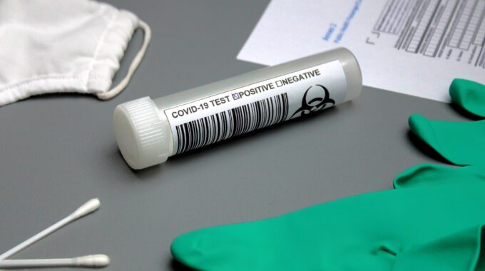 Covid-19-Teströhrchen auf türkiesem OP-Stoff
